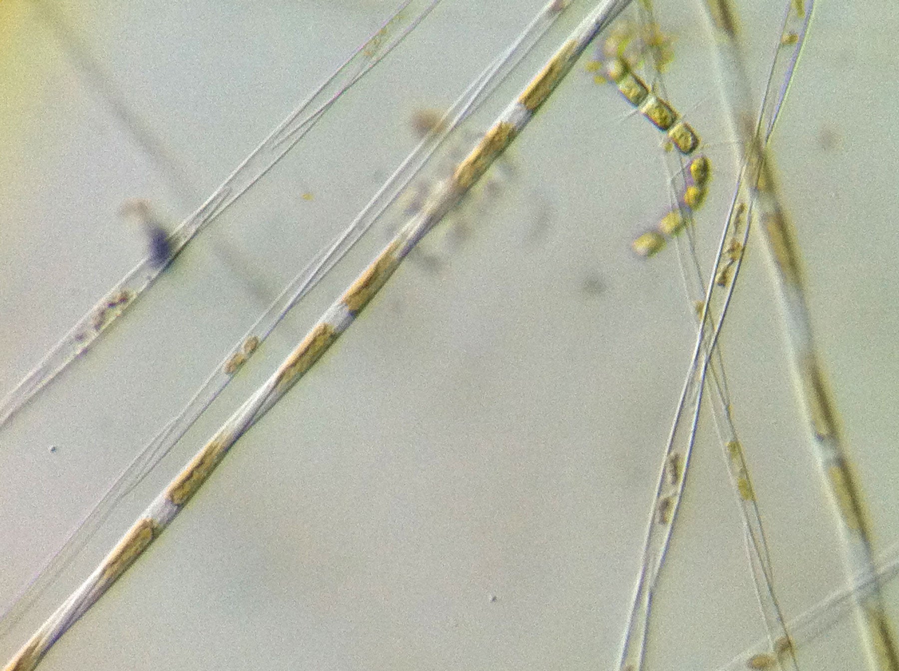 Pseudonitzschia toxic algae bloom