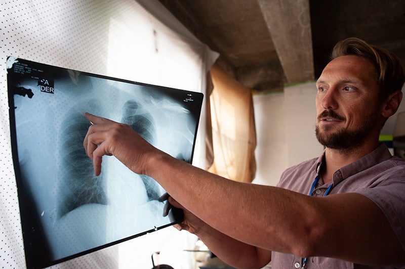 Todd Schneberk in a short-sleeve pink button-down shirt pointing to the collarbone on a chest X-ray illuminated against a window