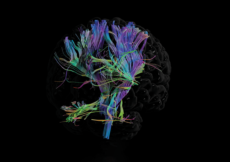 Tractography an advanced form of medical imaging