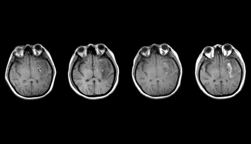brain scans in black and white