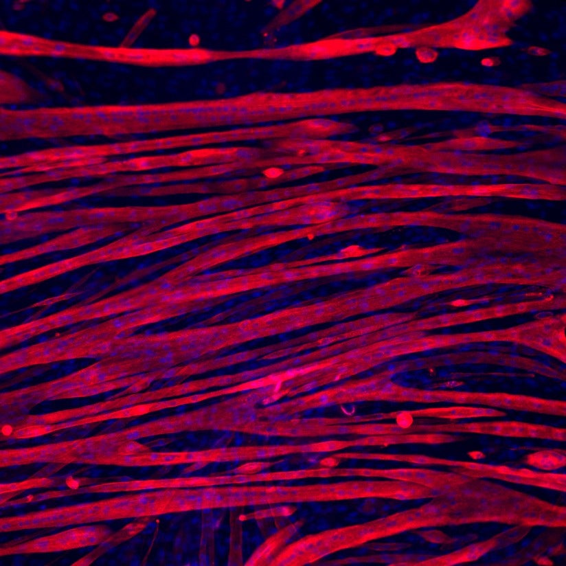 microscopic view of muscle fiber