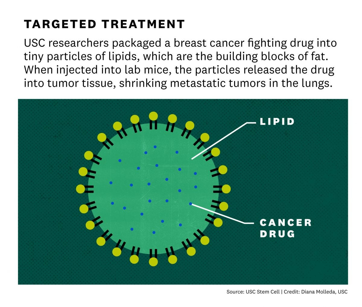 triple negative breast cancer metastasis