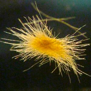 A COLONY OF TRICHODESMIUM BACTERIA ROUGHLY THE SIZE OF THE HEAD OF A PIN.