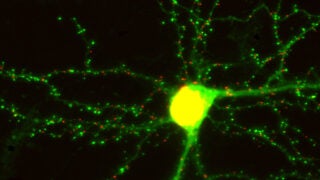 A living neuron displayed through red and green dots