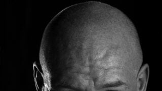 Closeup headshot of an older man slowly growing back hair
