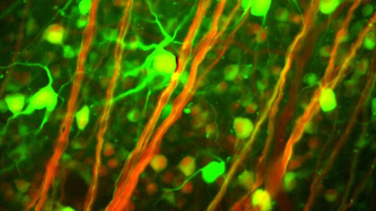 eye retina