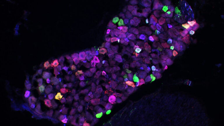 sensory neurons
