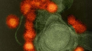 Close up of Zika virus