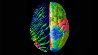 Brain of $21.7 million spurs USC research on how epilepsy develops