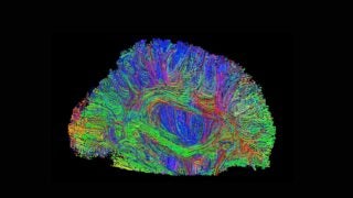 Brain scan
