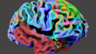 The brain of a quest to uncover the underlying causes of Alzheimer