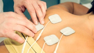 Therapist applying TENS electrodes
