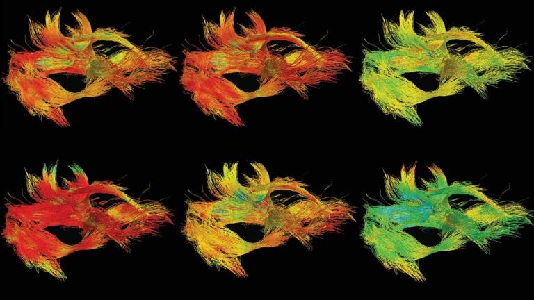 Neurology scans