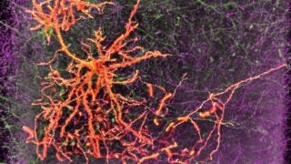 scientific imaging of neuron cell