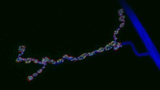 neuromuscular synapse
