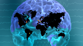 enigma epilepsy brain image