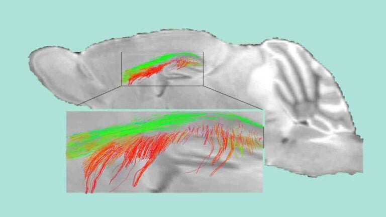 diffusion MRI