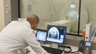 doctor examining MRI scan