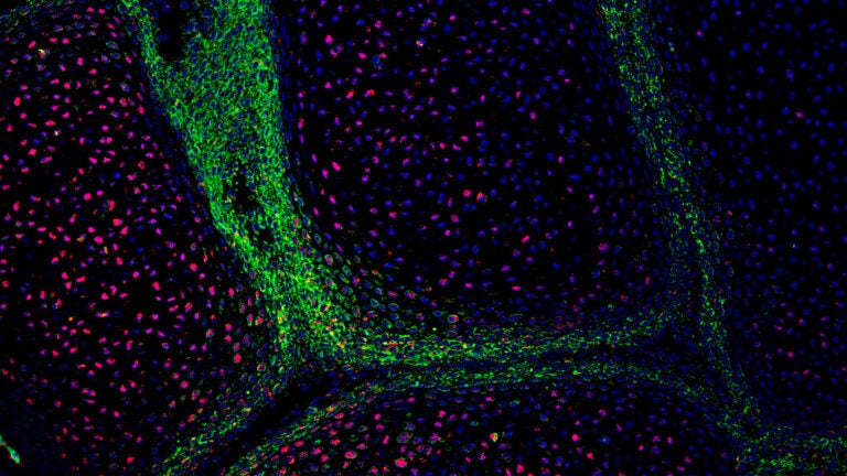 skeletal stem cells