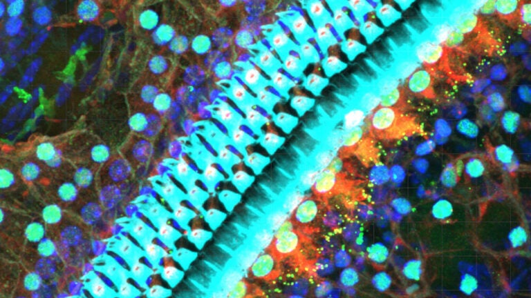 sensory hair cells