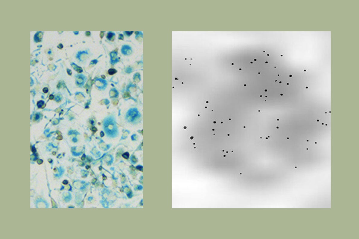 MRI resolution enhanced at cellular level in breakthrough USC study