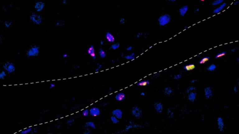 nanoparticles