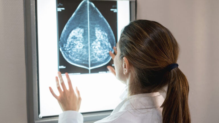 Doctor looking at a brain scan