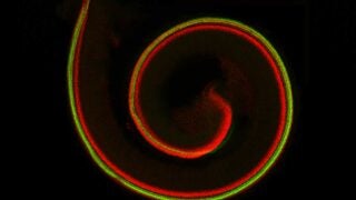 In a developing mouse, the Organ of Corti contains sensory cells (green) and supporting cells (red).