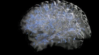 brain mapping image