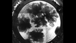 Close up of Lung organoids