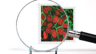 Tiny scientists looking through a microscope at a stamp with a photo of cancer