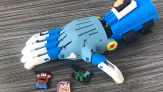 prosthetic hand