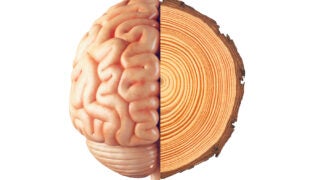 Half a brain juxtaposed next to a tree stump