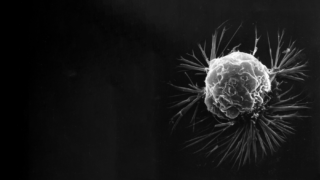 breast cancer screening