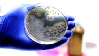 MRSA vaccine: Bacterial colonies of MRSA