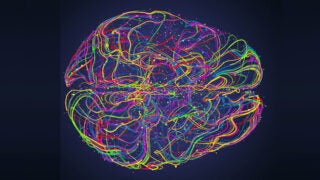 Visual of brain imaging showing colorful lines