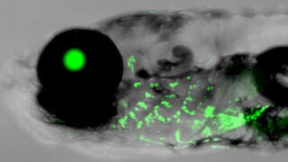 Human outer ear development