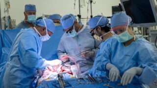 Bladder transplant