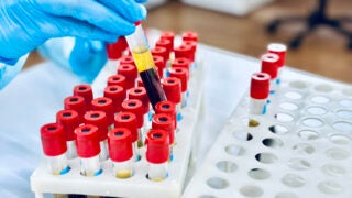 Test tube samples