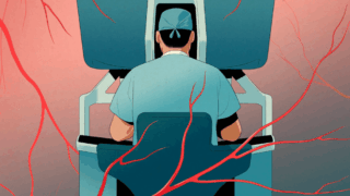 A surgeon sitting at a robotic system with red veins all round.
