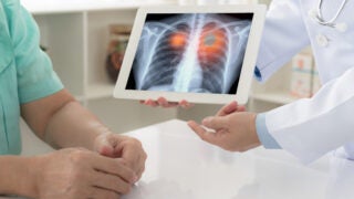 Clinician and patient with x-ray