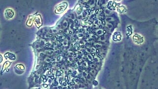 Embryonic stem cells