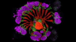 Lab grown human kidney assembloid