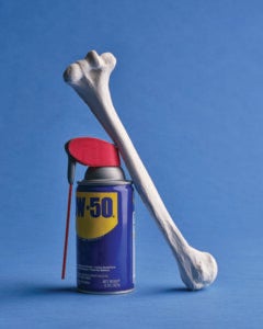 A "regenerative pouch" derived from stem cells replaces damaged cartilage after a fall. (Illustration/Derek Brahney)